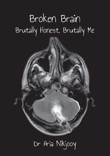 Broken Brain: Brutally Honest, Brutally Me