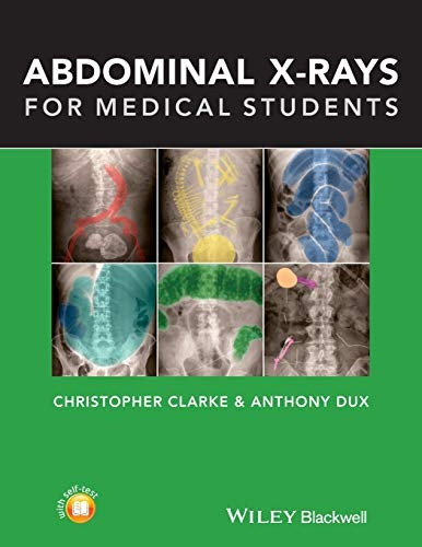 Abdominal X-Rays for Medical Students