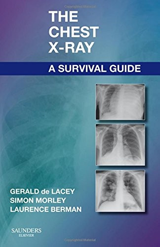 The Chest X-Ray Survival Guide