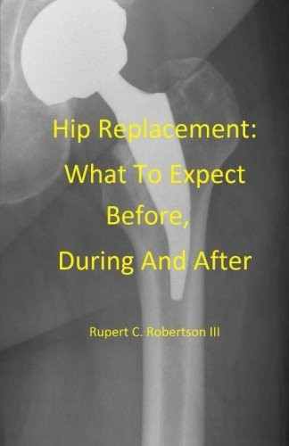 Hip Replacement: What to Expect Before, During and After
