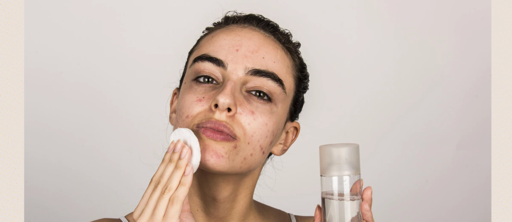 How to Care for Acne-Prone and Blemish-Prone Skin