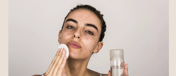 How to Care for Acne-Prone and Blemish-Prone Skin