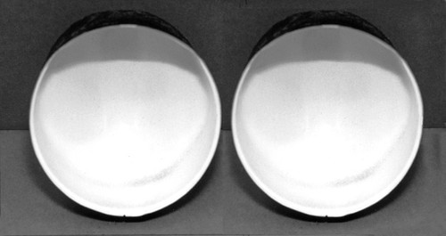 911 headlight buckets