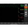 Laerdal® TruMonitor 2-Year Subscription