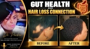Your Gut Health May Be Talking to Your Hair