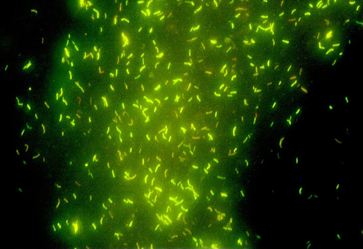 OPTIKA B-293LD1 - Trinocular LED Fluorescence Microscope (100x Dry)