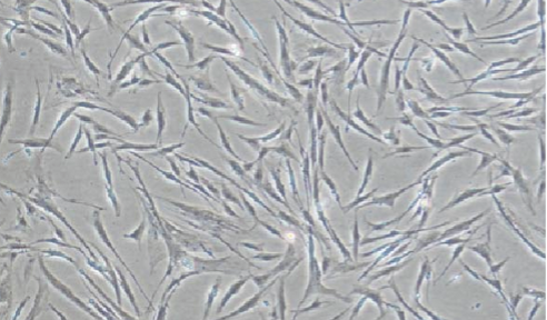 ORF- Human Adipose Derived Mesenchymal Stem Cells (Low Passage)