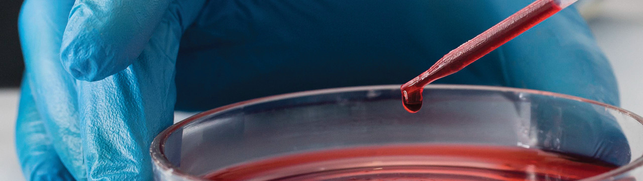 Common Blood Test Marker Predicts Faster Alzheimer’s Decline, New Study Shows