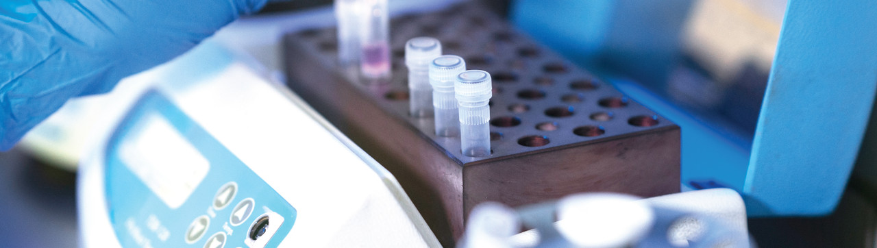 PCR Reagent Selection 101: Expert Tips for Accuracy and Efficiency