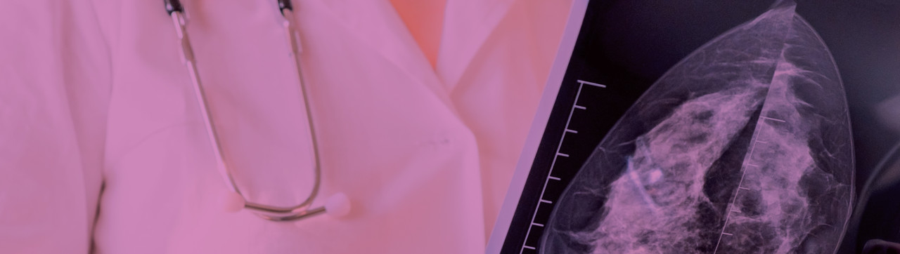 New Data on Early-Onset Breast Cancer Raises Urgency for Precision Diagnostics