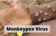 CDC Recommendation for MonkeyPox Molecular Detection