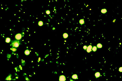 OPTIKA  - Trinocular LED Fluorescence Microscope