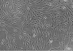 ORF - Human Bone Marrow Derived Mesenchymal Stem Cells (Low Passage)
