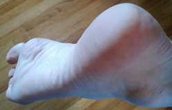 Cracked Heel Testimonial - Tallow Balm