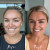 Mother of Tan Botanique Facial Glaze Before and After