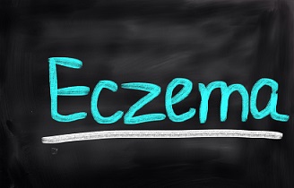 eczema-on-chalkboard.jpg