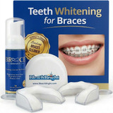 Can You Use Whitening Strips With Braces? (What Works)