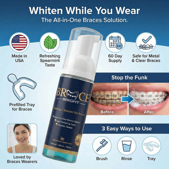 Teeth Whitening for Braces