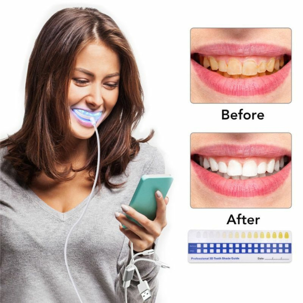 Share-A-Smile ibright Smartphone Whitening System (2 Pack)
