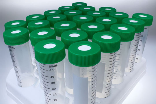 25 clear centrifuge tubes with green SeptaSecure silicone septa caps standing upright in a tray.