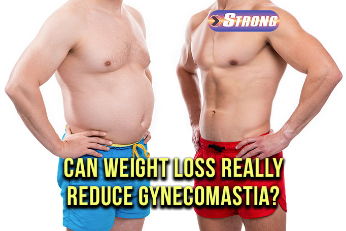 ​Can Weight Loss Really Reduce Gynecomastia?