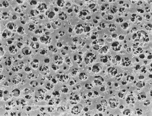 CA Membrane; 5.0um; 25mm; 100pc 
 {2997-1234225N PK}