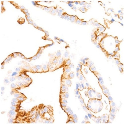 MAB MOUSE BRAF V600E IHC600 COLON 5 ML - 786-1423