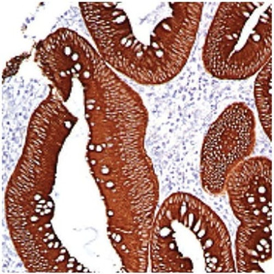 MAB CYTOKERATIN COCKTAIL IHC559 5 ML - 786-1453