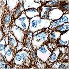 MAB CYTOKERATIN 14 IHC555 SQUAMOUS 5 ML - 786-1444