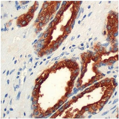 MAB MOUSE PSAP IHC655 PROSTATE 5 ML - 786-1489