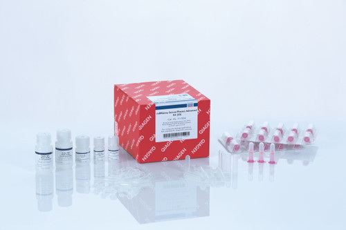 For phenol-free isolation of total RNA including miRNA from se