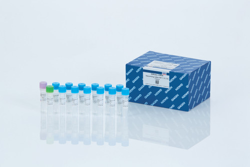 Gel-free miRNA Sample to Insight solution for differential exp
