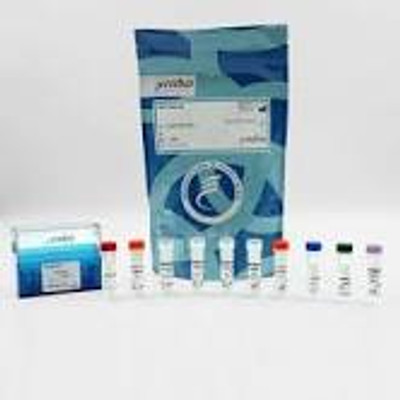 Total AKT1 cellular kit, 50000 Tests 
 {2013-63ADK079PEY KT}