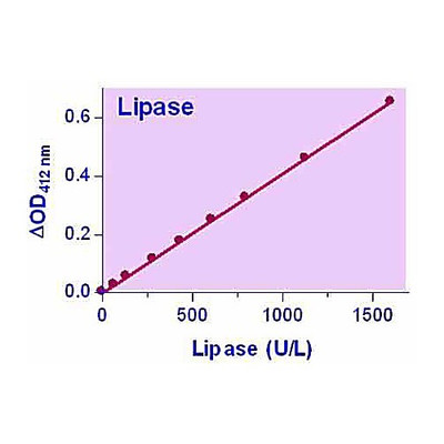QuantiChrom Lipase Kit, 100ASY
