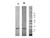 rHuman Chemerin Protein 1mg {2976-009001U701000}