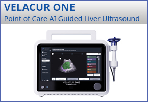 Velacur One - Point of Care AI guided liver ultrasound.