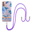 For Motorola Moto G30 / G20 / G10 / G10 Power Flowers Series TPU Phone Case with Lanyard(Blue Peony)