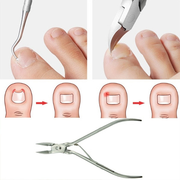 Ingrown Foot Care Tool Toe Nail Correction Nippers Clipper Cutters Dead Skin Dirt Remover(2PCS/set)