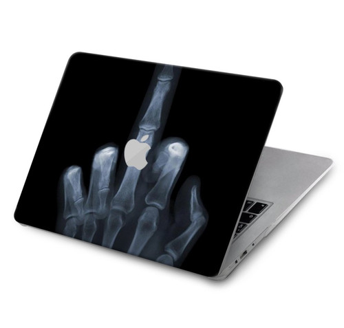 W1143 X-ray Hand Middle Finger Hard Case Cover For MacBook Air 15″ (2023,2024) - A2941, A3114