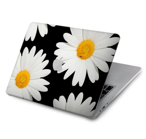 W2477 Daisy flower Hard Case Cover For MacBook Air 15″ (2023,2024) - A2941, A3114
