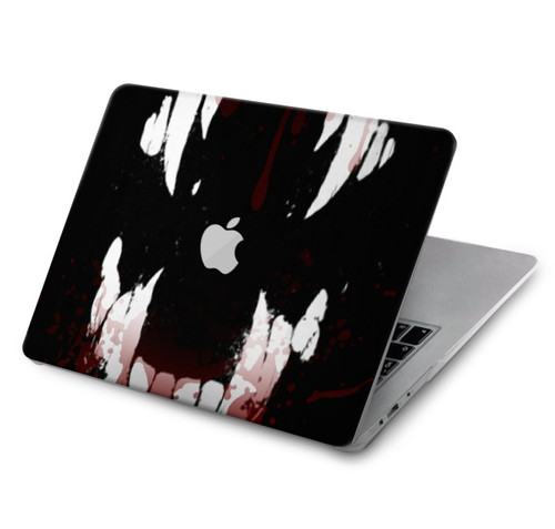 W3527 Vampire Teeth Bloodstain Hard Case Cover For MacBook Air 15″ (2023,2024) - A2941, A3114