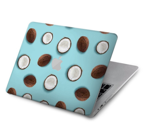 W3860 Coconut Dot Pattern Hard Case Cover For MacBook Air 15″ (2023,2024) - A2941, A3114