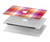 W3941 LGBT Lesbian Pride Flag Plaid Hard Case Cover For MacBook Air 13″ (2022,2024) - A2681, A3113