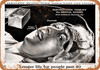 1948 Electro-Shock Therapy for Mental Illness - Metal Sign