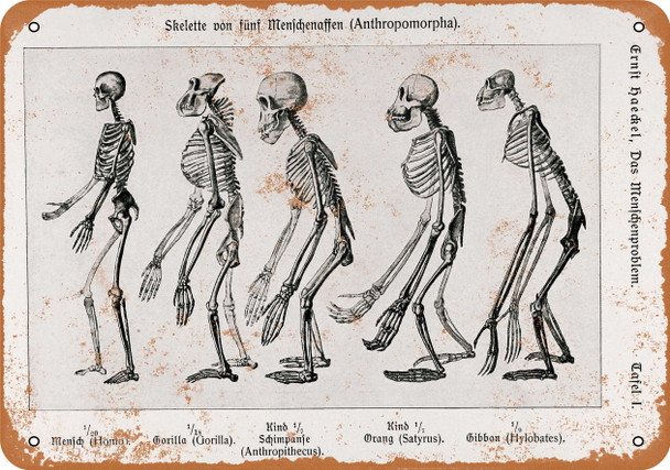 1907 Man and Ape Skeletal Comparison - Metal Sign
