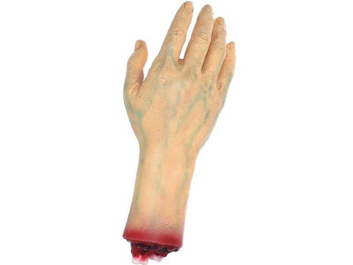 Severed Right Hand