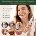 Electric Ultrasonic Dental Scaler Calculus Oral Tartar Remover Tooth Stain Cleaner Teeth Cleaner Plaque Remover product image