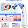Sacato Blackhead Remover Pore Vacuum product image