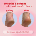 Onyx Professional Cracked Heel Treatment (2-Pack) product image