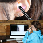 iMounTEK® Ear Cleaning Endoscope Camera product image